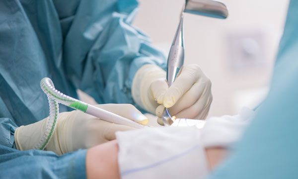 Wie beeinflusst eine Trichter- / Kielbrust die Technik einer Brustoperation?