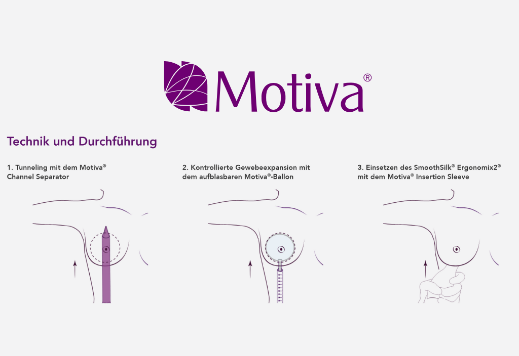 motiva-preserve-breast-atelier-zuerich